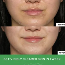 BALANCE Detox Drops 2% Salicylic Acid Toner