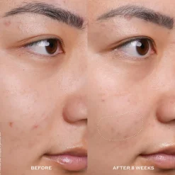 Banana Bright Vitamin C Serum