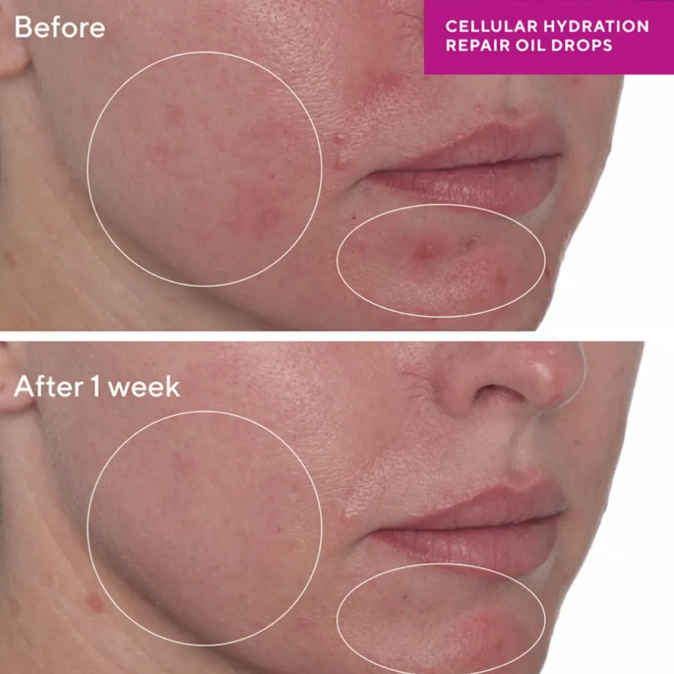 Cellular Hydration Repair Oil Drops