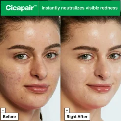 Cicapair Tiger Grass Color Correcting Treatment