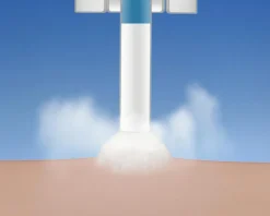 Cryotherapy Frysebehandling