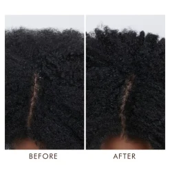 Dry Scalp Treatment
