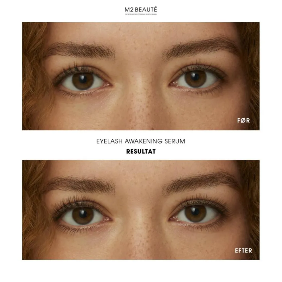 Eyelash Awakening Serum