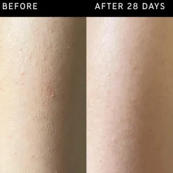 Glycolic Acid Exfoliating Body Stick