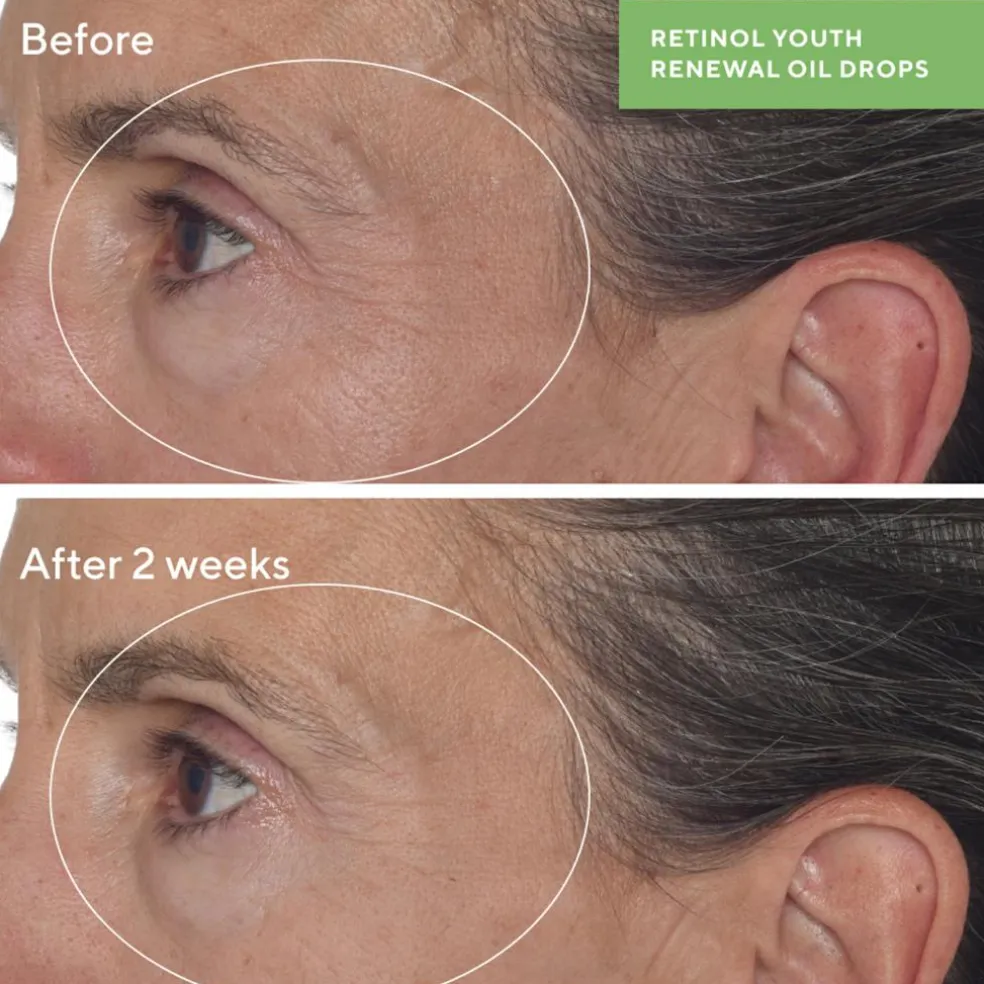 Retinol Youth Renewal Oil Drops