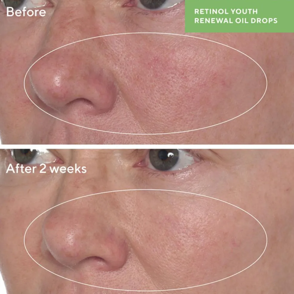 Retinol Youth Renewal Oil Drops