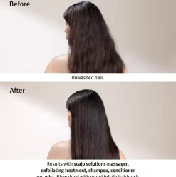 Scalp Solutions Overnight Recovery Serum