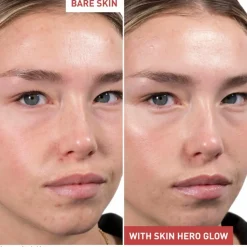 Skin Hero Glow