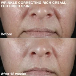 Smart Clinical Repair Wrinkle Rich Cream