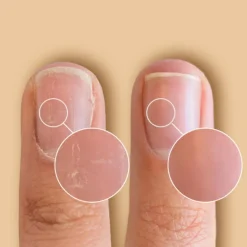 SolarOil Nail & Cuticle Care