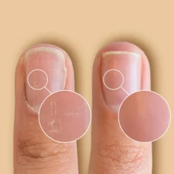 SolarOil Nail & Cuticle Care