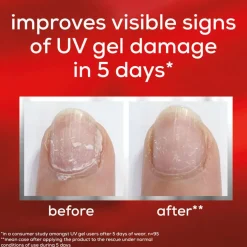 To the Rescue Neglepleje til Negle som er Skadet af Gellack