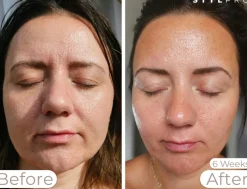 Wavelength LED Face Mask